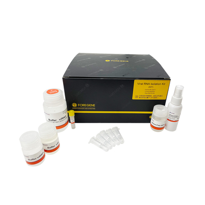 200 Stücke RNS Isolierungs-Ausrüstungs-RNase freie RNS nur Spalte hohe RNS MiRNA Isolation Kits From Serum 200ul